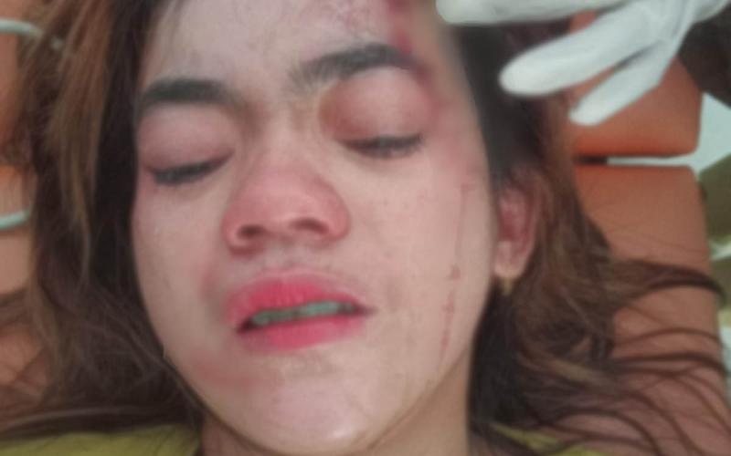 Bela Suami, Ibu Muda di Lebong Dianiaya