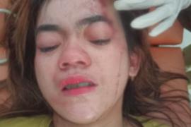 Bela Suami, Ibu Muda di Lebong Dianiaya